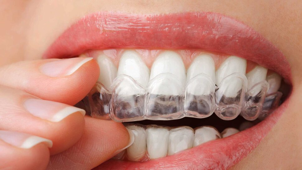 Зубы пластмассовые