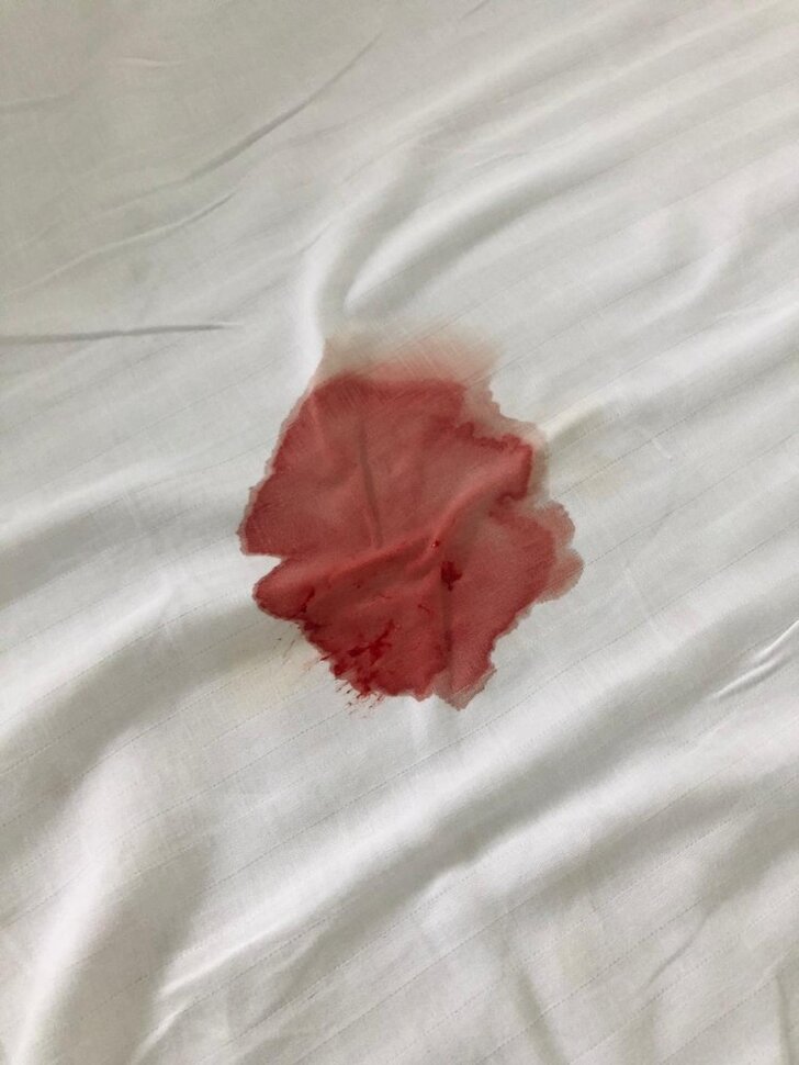 Сгустки Крови После Секса