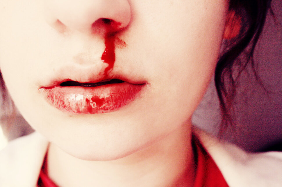 Кровь из носа