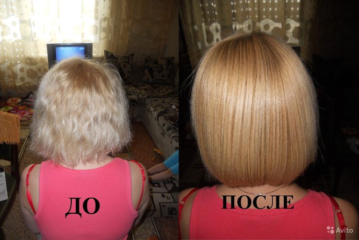 Как избежать облысения Как избежать облысения