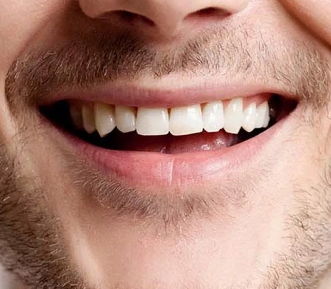 Открытый рот мужчины. Красивые зубы. Красивые крупные зубы. Улыбка мужская. Зубы мужские.