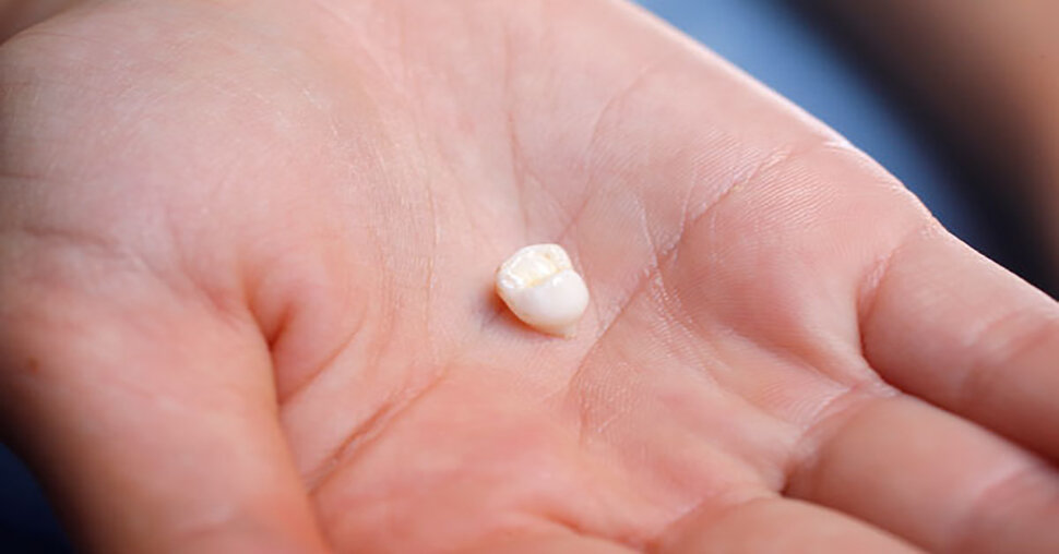 Белый зуб
