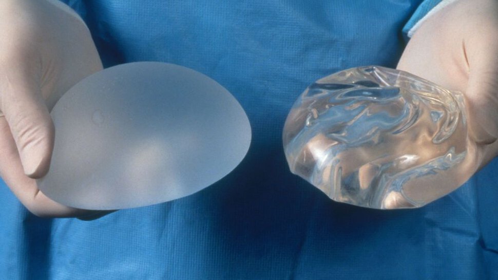 Силиконовые имплантаты в грудь