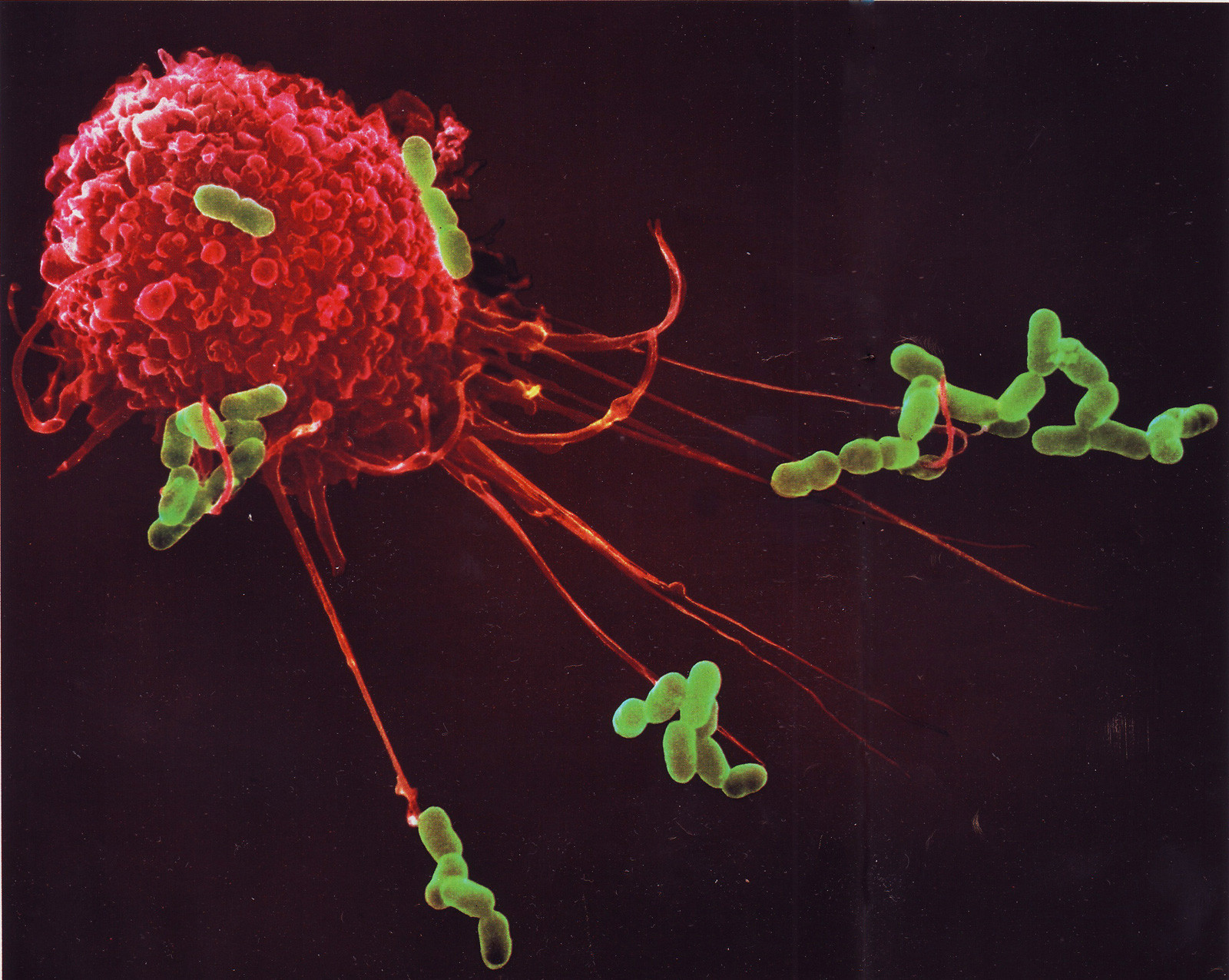 Иммунная система бактерий. Иммунные клетки макрофаги. Иммунитет фагоциты. Фагоцит микрофотография. Клетки фагоциты.