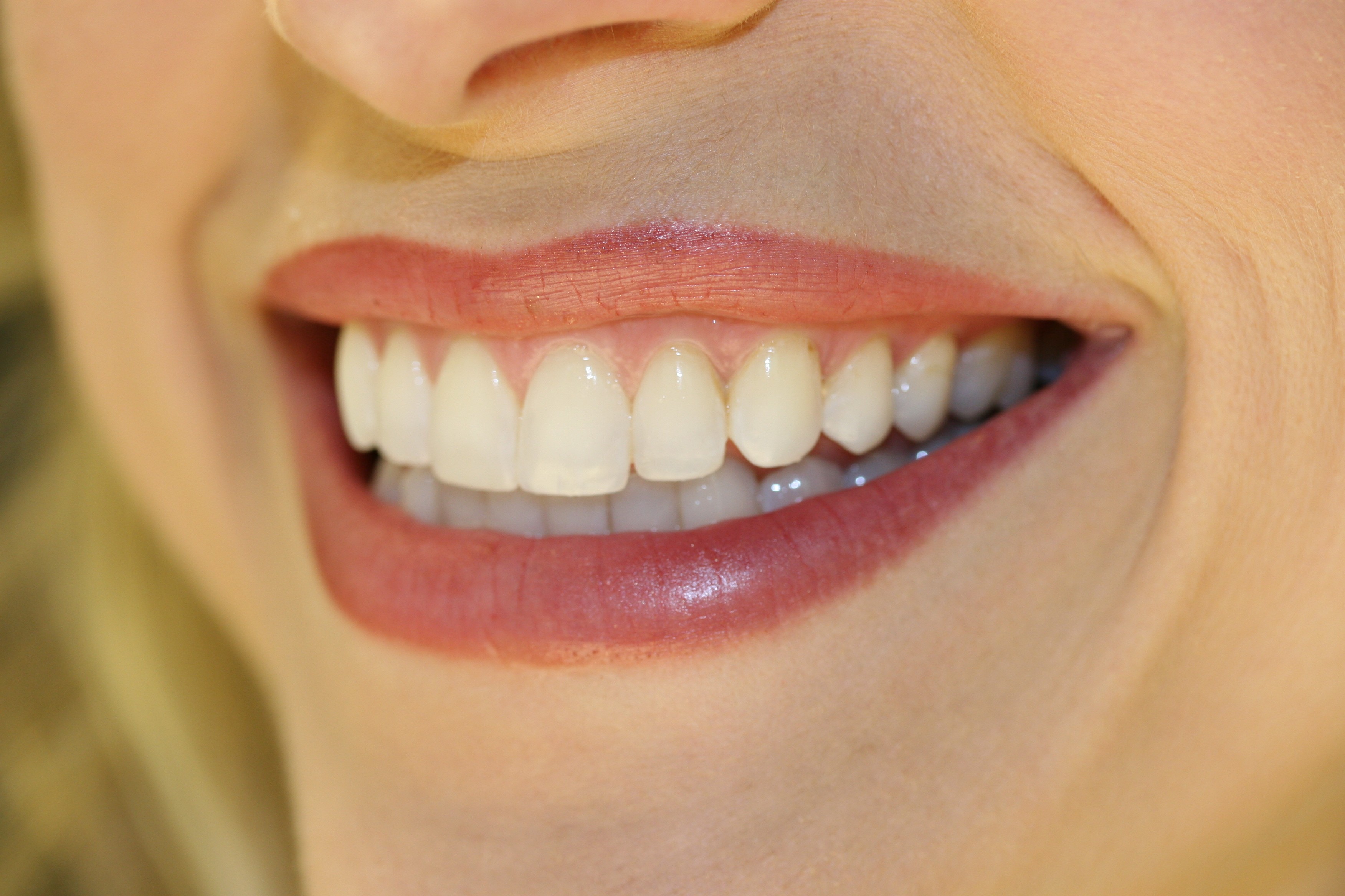 Звонкий улыбка. Красивые зубы. Красивые ровные зубы. Красивая улыбка. Красивая улыбка зубы.