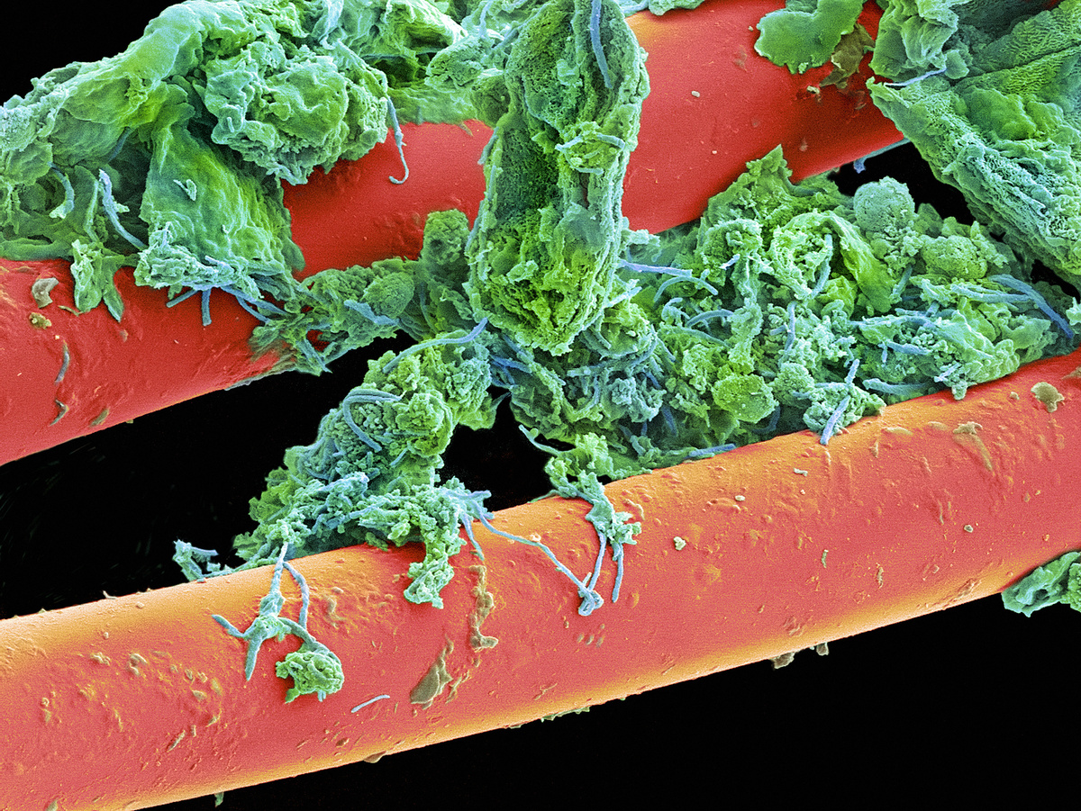 Бактерии в слюне. Бациллы бактерии под микроскопом. Микроомы под микроскопом. Микроробы под микроскопом. Бакетриипод микроскопом.