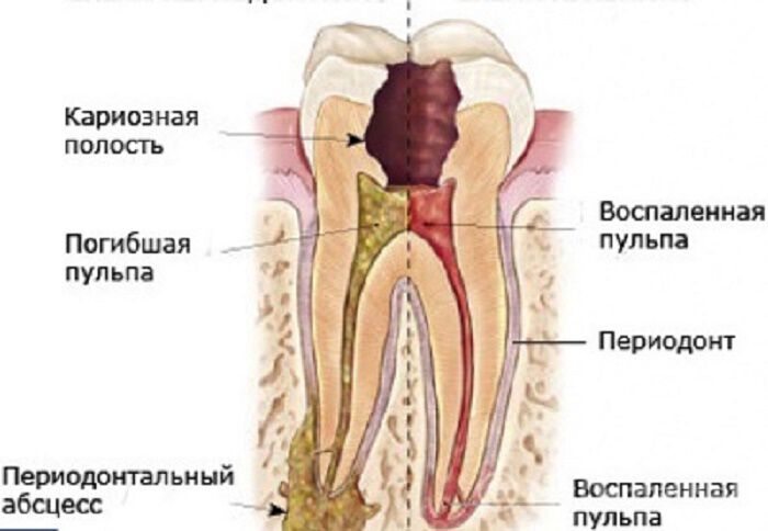 Больные зубы