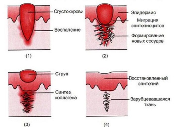 Регенерация от травмы